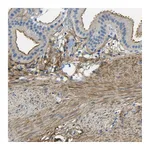 Atlas Antibodies Anti-OGN Antibody