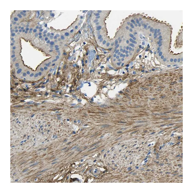 Atlas Antibodies Anti-OGN Antibody