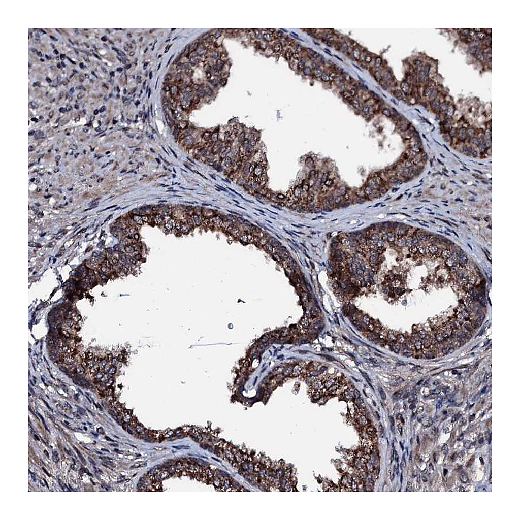 Atlas Antibodies Anti-OGFOD2 Antibody