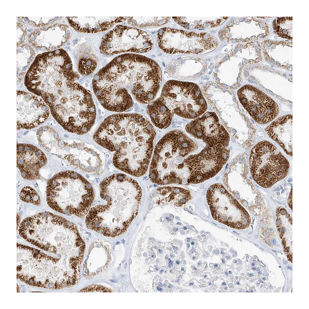 Atlas Antibodies Anti-OGT Antibody