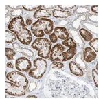 Atlas Antibodies Anti-OGT Antibody