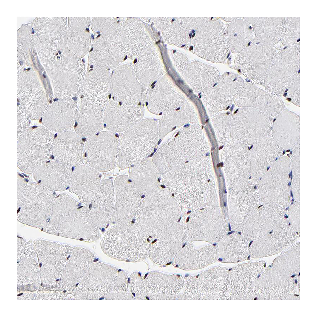 Atlas Antibodies Anti-OGFOD1 Antibody