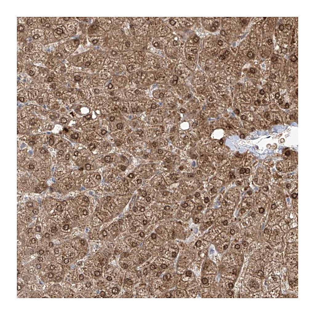 Atlas Antibodies Anti-OGT Antibody