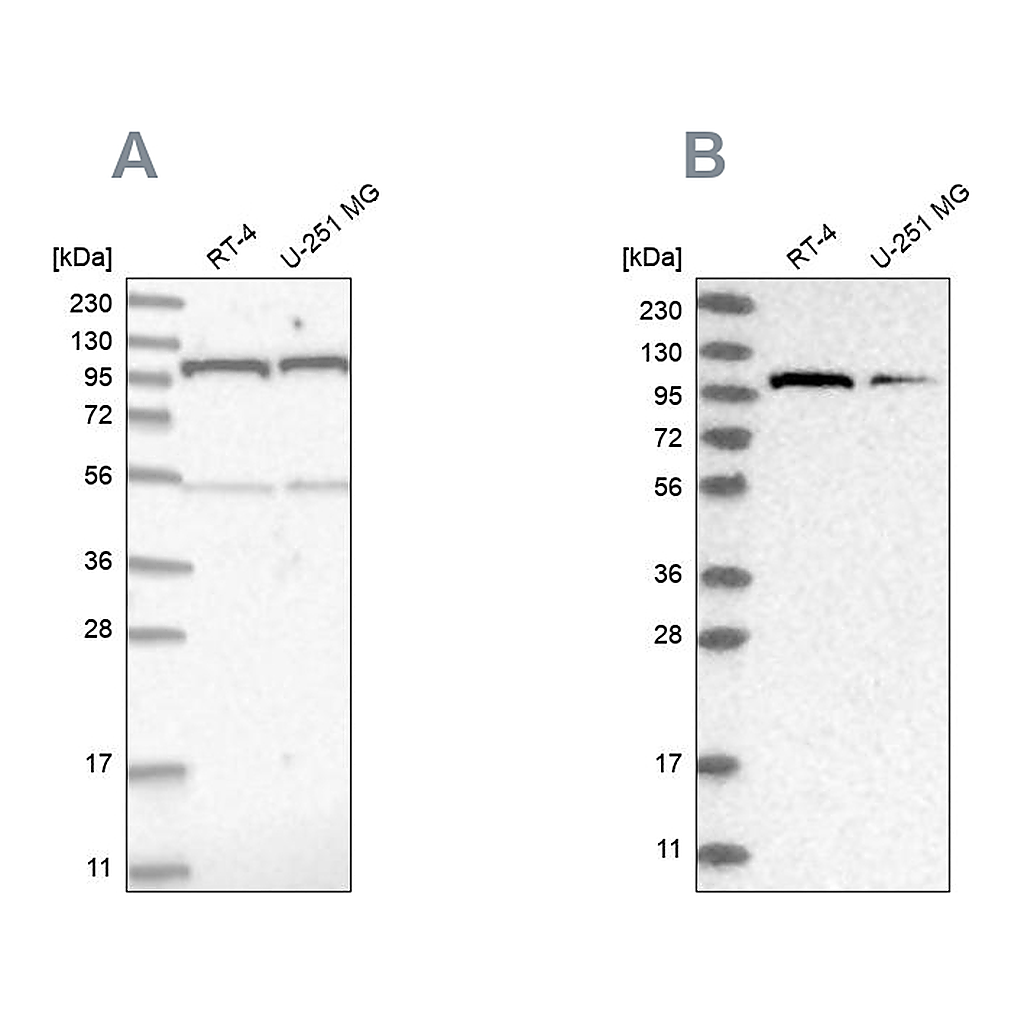 Atlas Antibodies Anti-OGT Antibody
