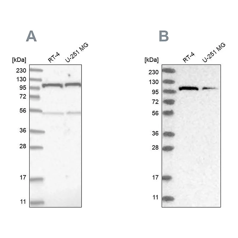 Atlas Antibodies Anti-OGT Antibody