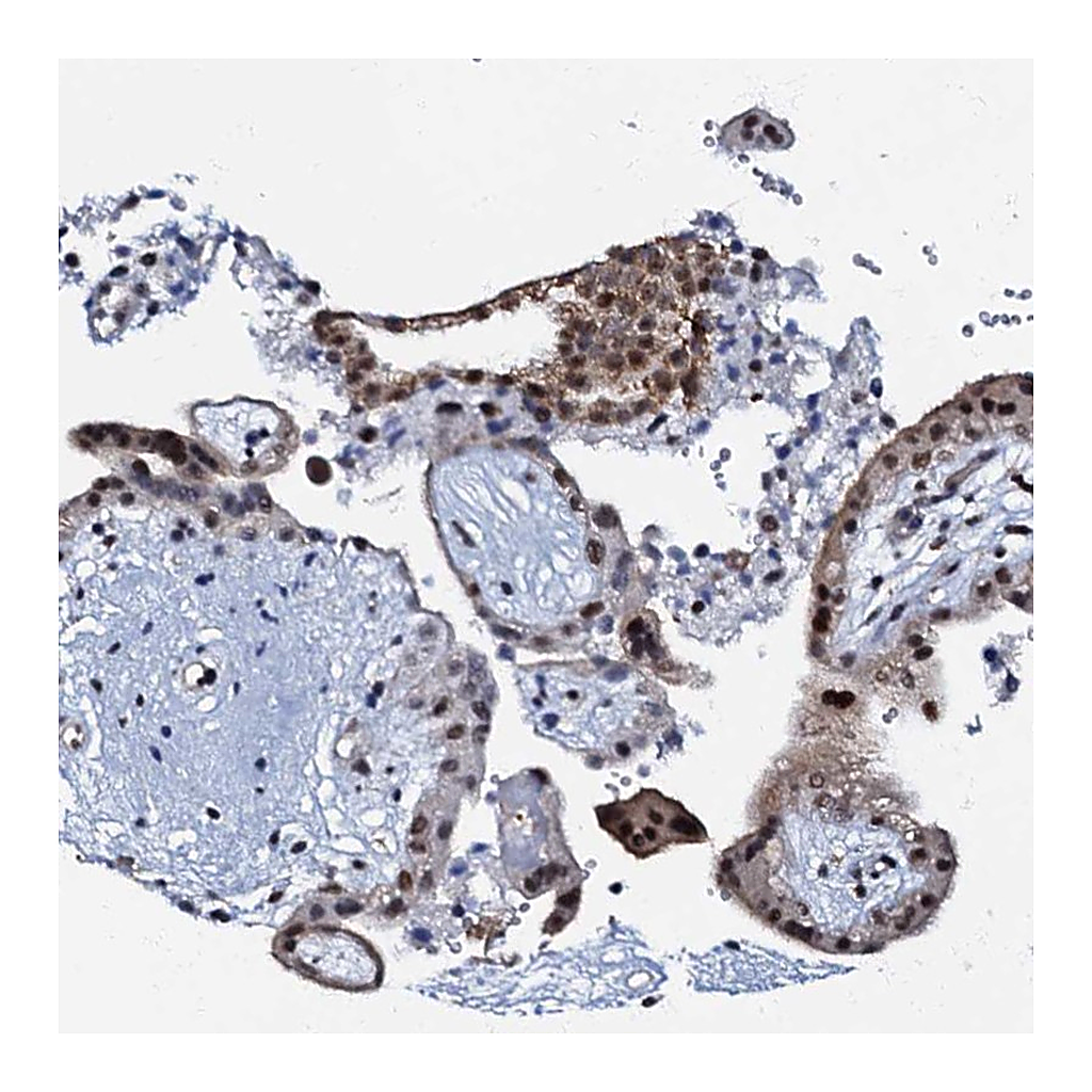 Atlas Antibodies Anti-OLAH Antibody