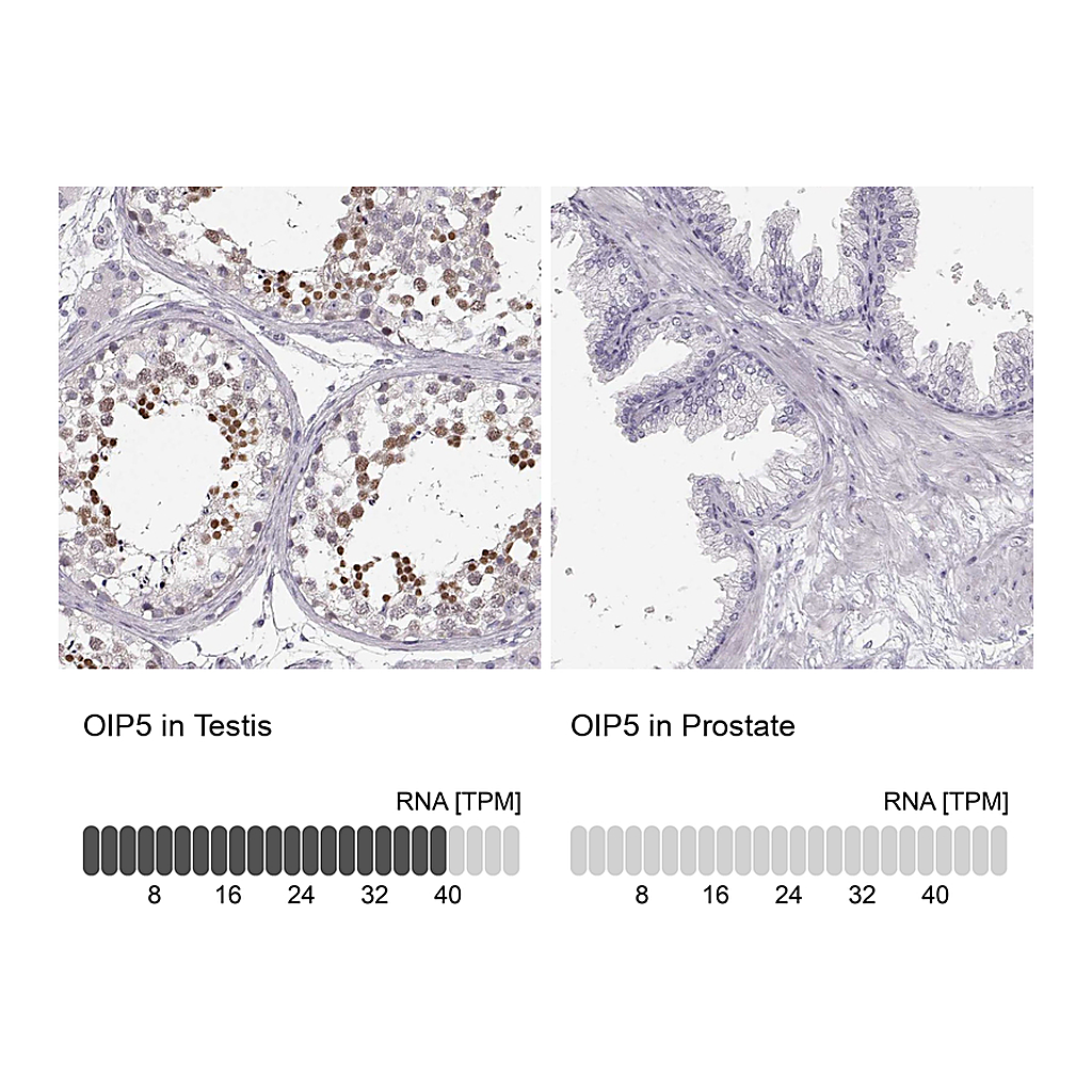 Atlas Antibodies Anti-OIP5 Antibody