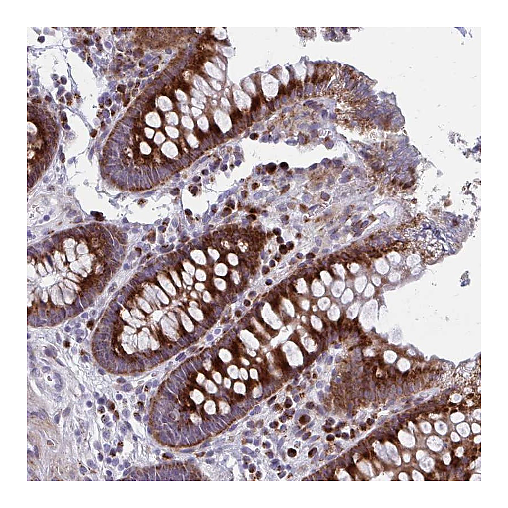 Atlas Antibodies Anti-OLFM2 Antibody