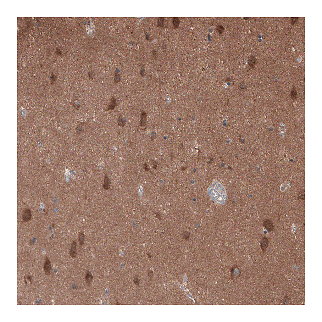 Atlas Antibodies Anti-OLA1 Antibody