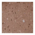 Atlas Antibodies Anti-OLA1 Antibody