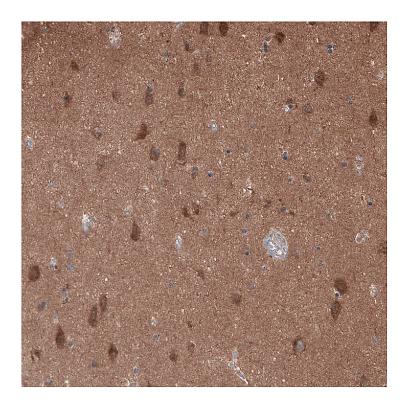 Atlas Antibodies Anti-OLA1 Antibody