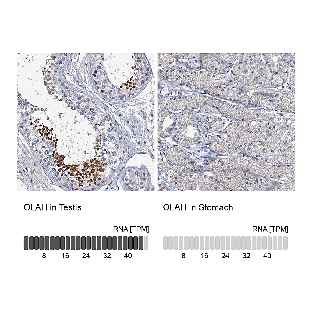 Atlas Antibodies Anti-OLAH Antibody