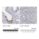 Atlas Antibodies Anti-OLAH Antibody