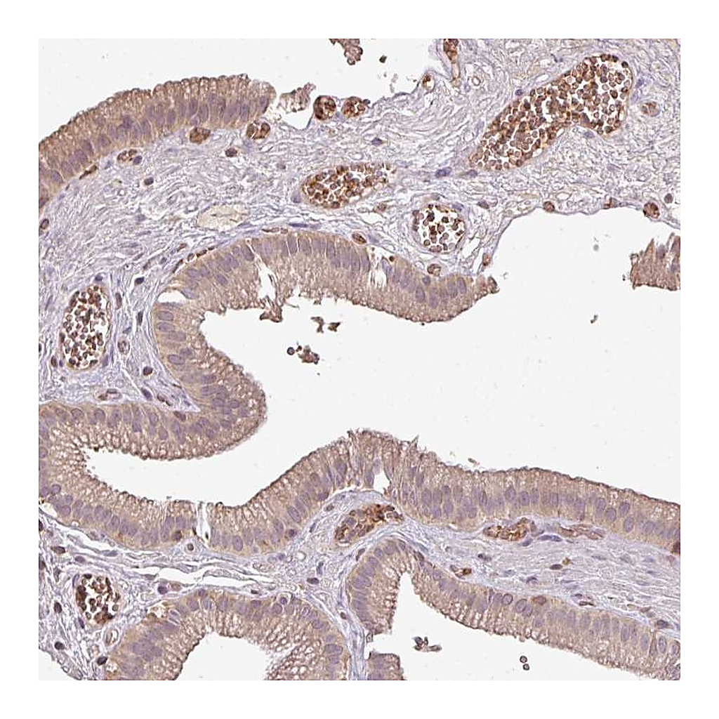 Atlas Antibodies Anti-OLFML2B Antibody