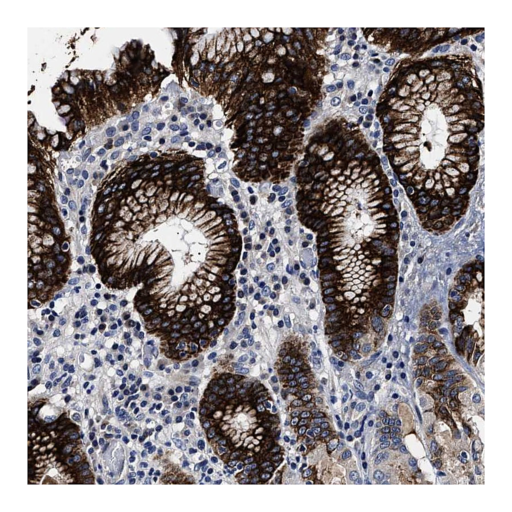 Atlas Antibodies Anti-OLFML2A Antibody