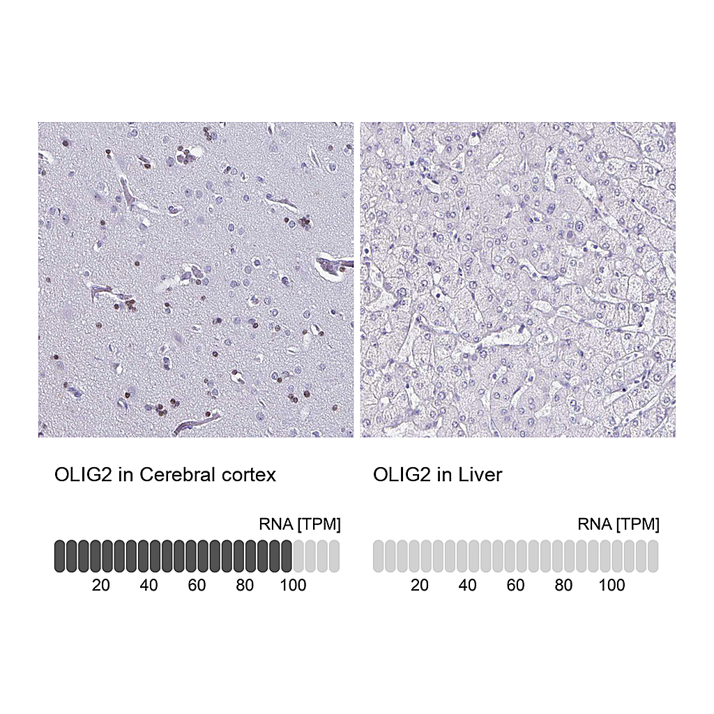 Atlas Antibodies Anti-OLIG2 Antibody