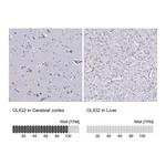 Atlas Antibodies Anti-OLIG2 Antibody
