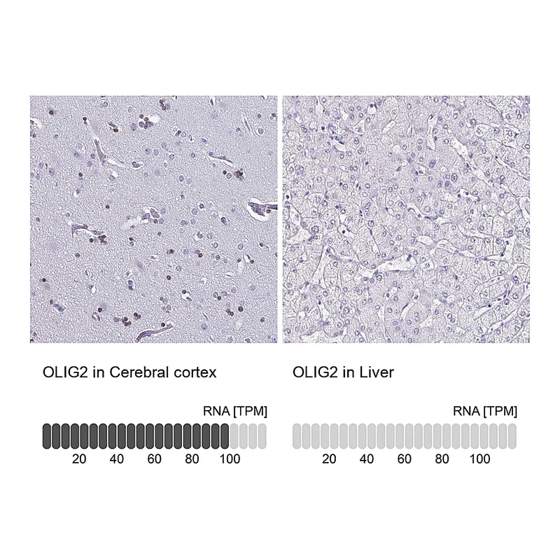 Atlas Antibodies Anti-OLIG2 Antibody