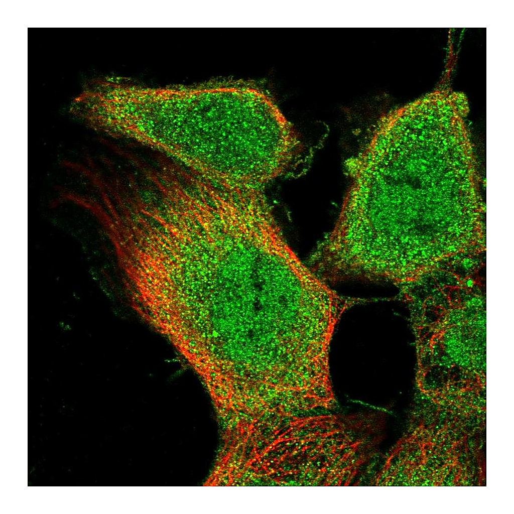 Atlas Antibodies Anti-OLR1 Antibody