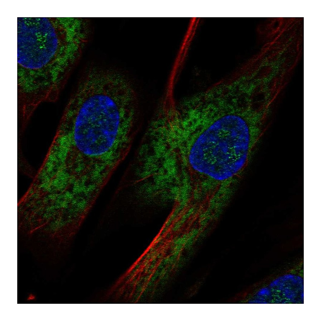 Atlas Antibodies Anti-OMD Antibody