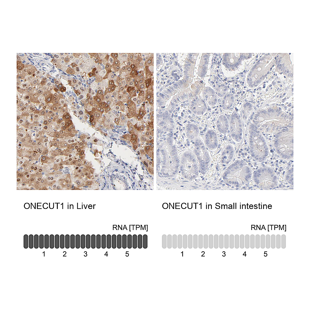 Atlas Antibodies Anti-ONECUT1 Antibody