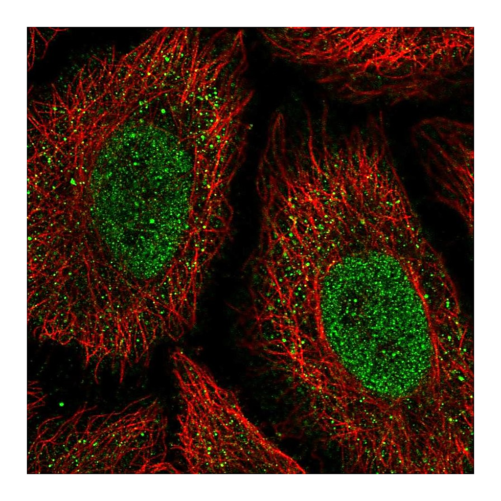Atlas Antibodies Anti-ONECUT2 Antibody