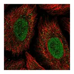 Atlas Antibodies Anti-ONECUT2 Antibody