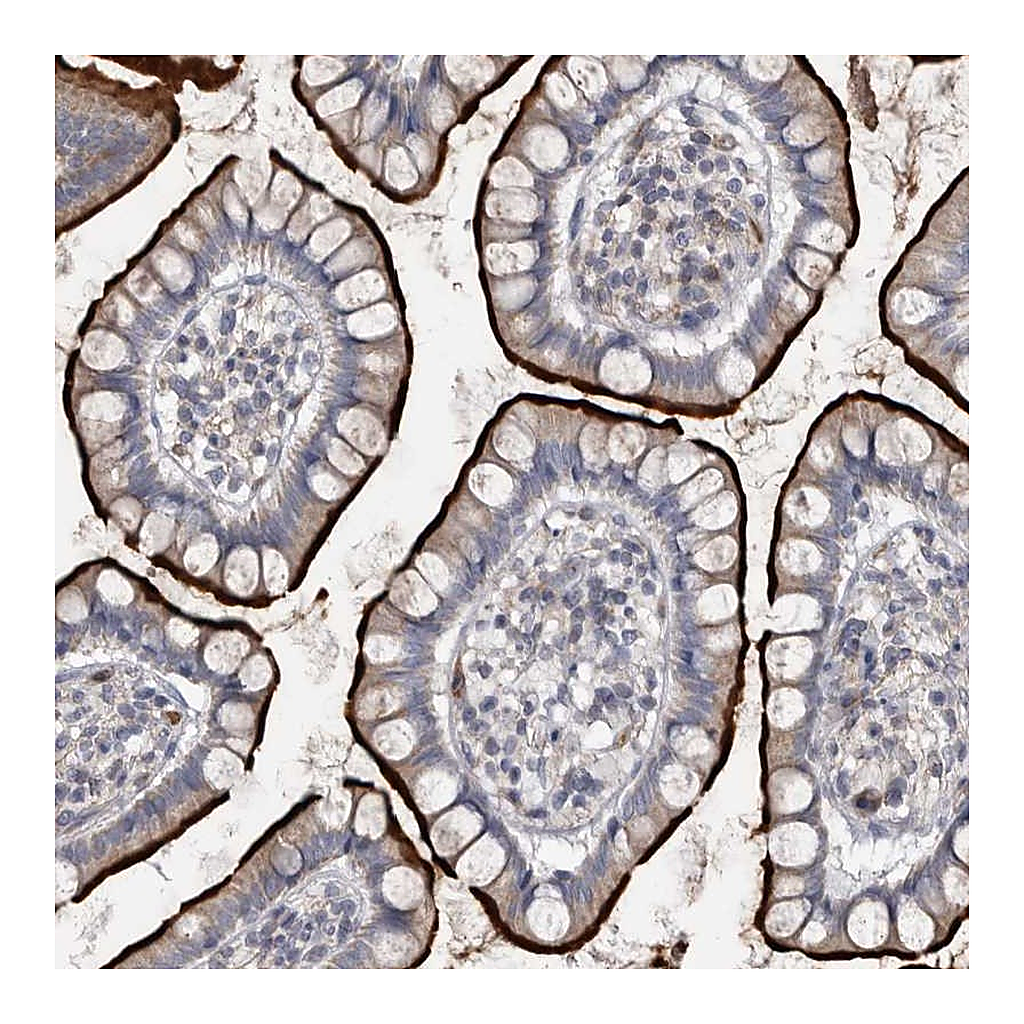 Atlas Antibodies Anti-OPLAH Antibody