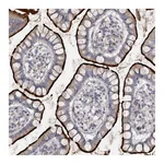 Atlas Antibodies Anti-OPLAH Antibody