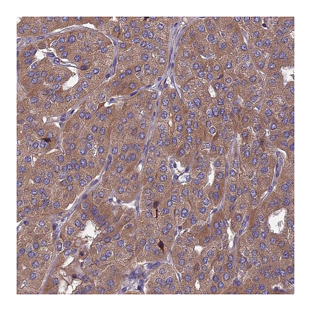 Atlas Antibodies Anti-OPA3 Antibody