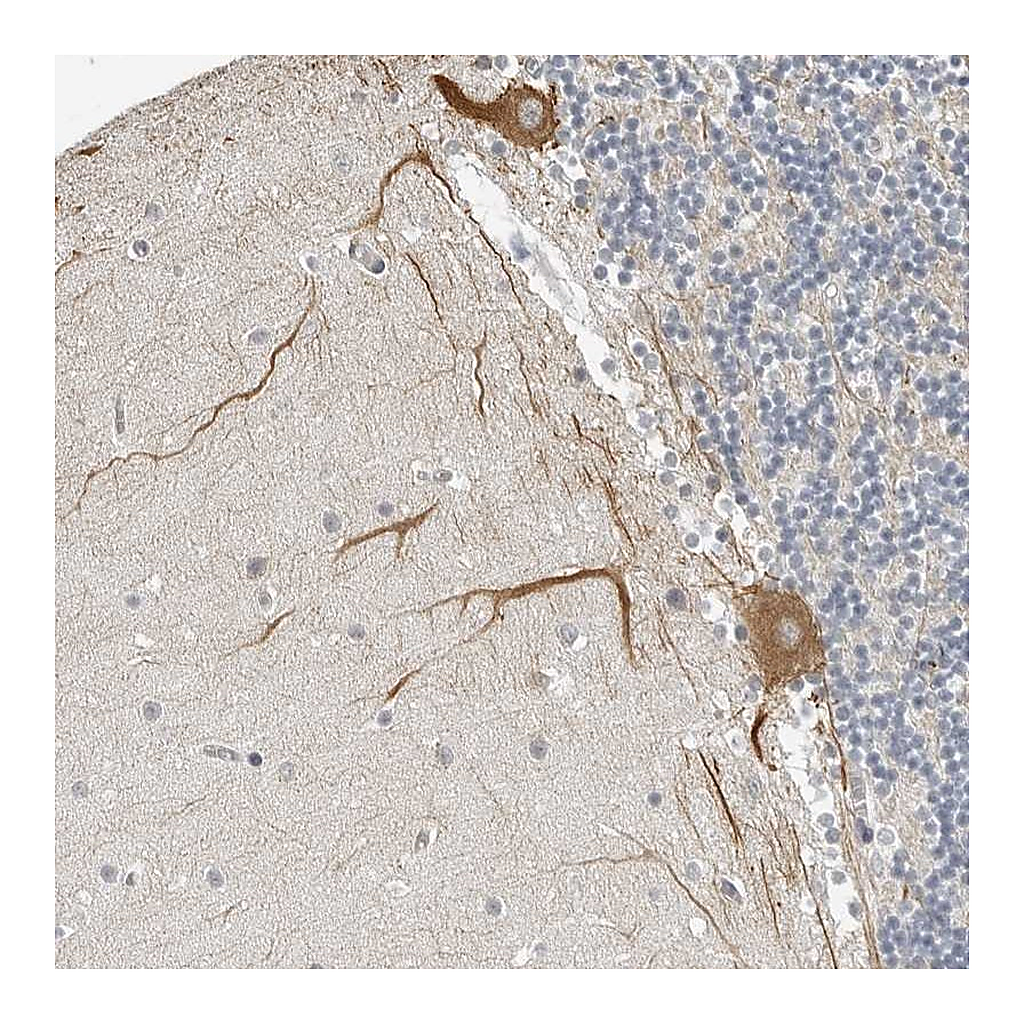 Atlas Antibodies Anti-OPLAH Antibody