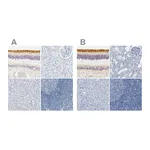 Atlas Antibodies Anti-OPN1SW Antibody