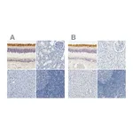 Atlas Antibodies Anti-OPN1SW Antibody