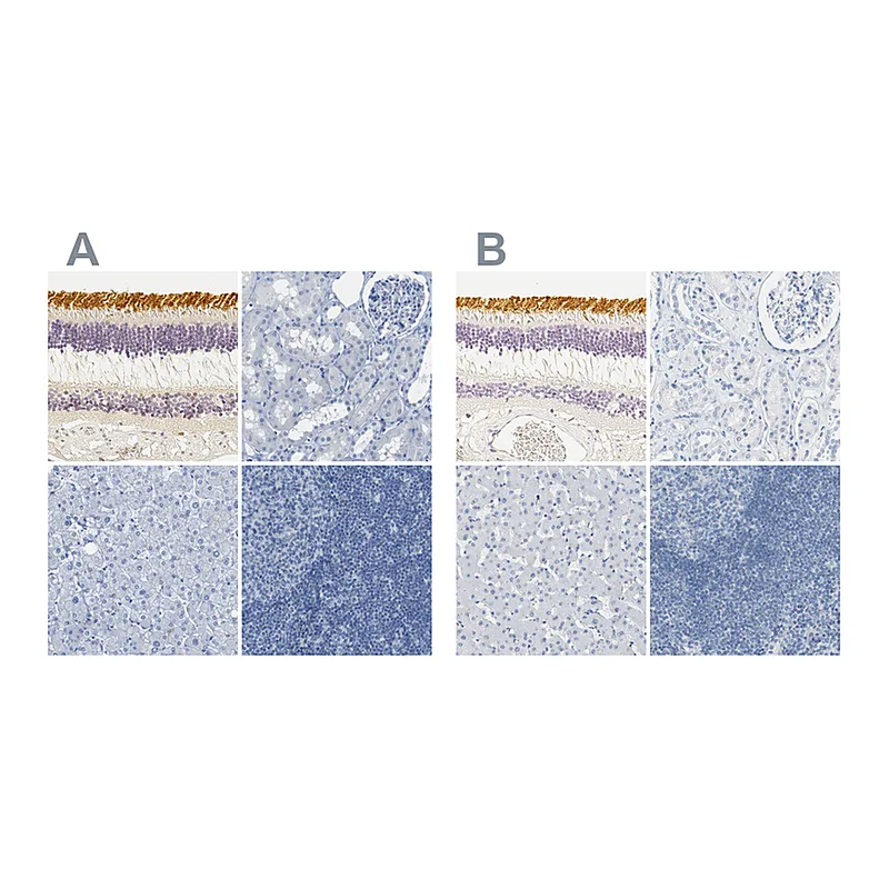 Atlas Antibodies Anti-OPN1SW Antibody