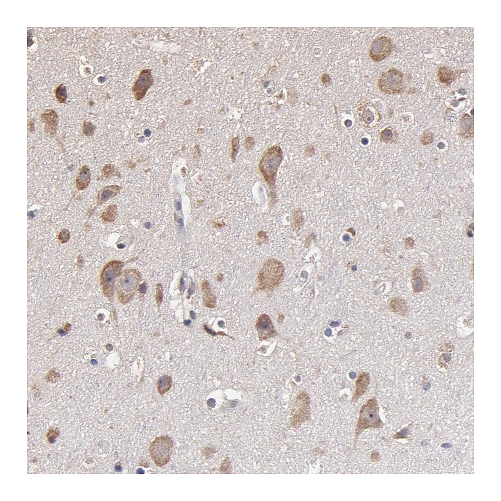Atlas Antibodies Anti-OPHN1 Antibody