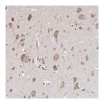 Atlas Antibodies Anti-OPHN1 Antibody