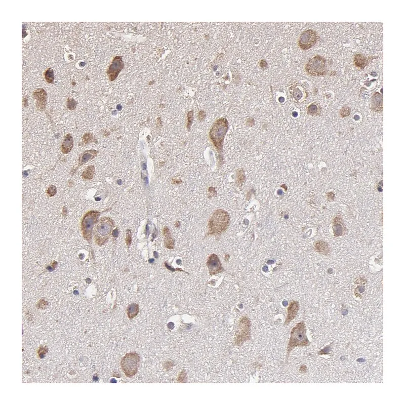 Atlas Antibodies Anti-OPHN1 Antibody