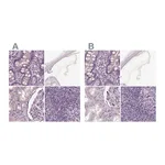 Atlas Antibodies Anti-OPTC Antibody