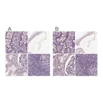 Atlas Antibodies Anti-OPTC Antibody