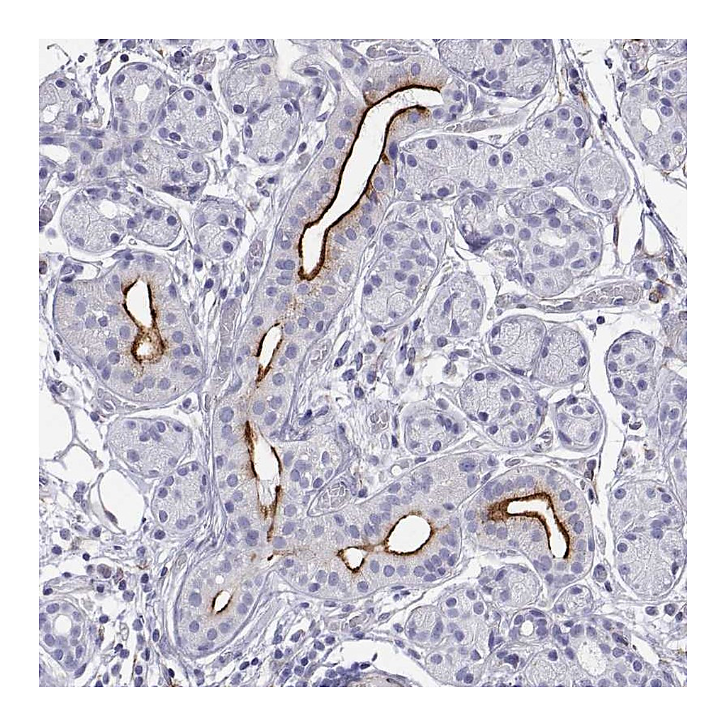 Atlas Antibodies Anti-OPRPN Antibody