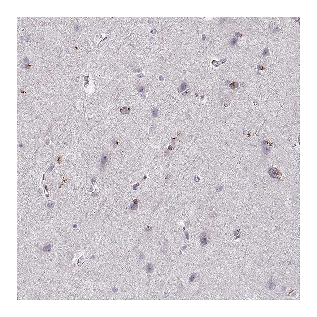 Atlas Antibodies Anti-OPRD1 Antibody