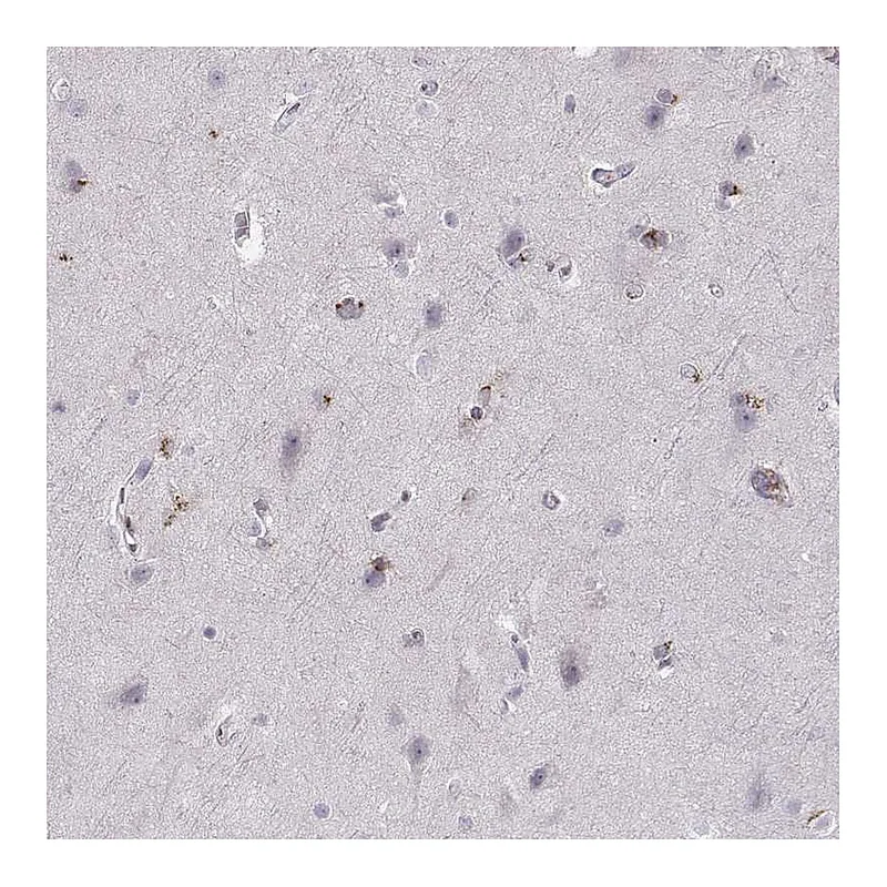 Atlas Antibodies Anti-OPRD1 Antibody