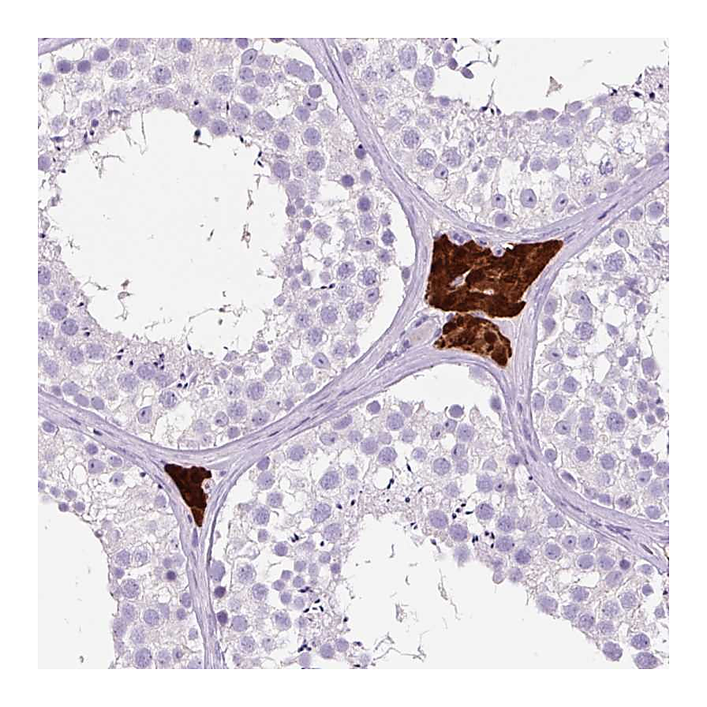 Atlas Antibodies Anti-OR10A7 Antibody