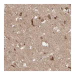 Atlas Antibodies Anti-OPTN Antibody