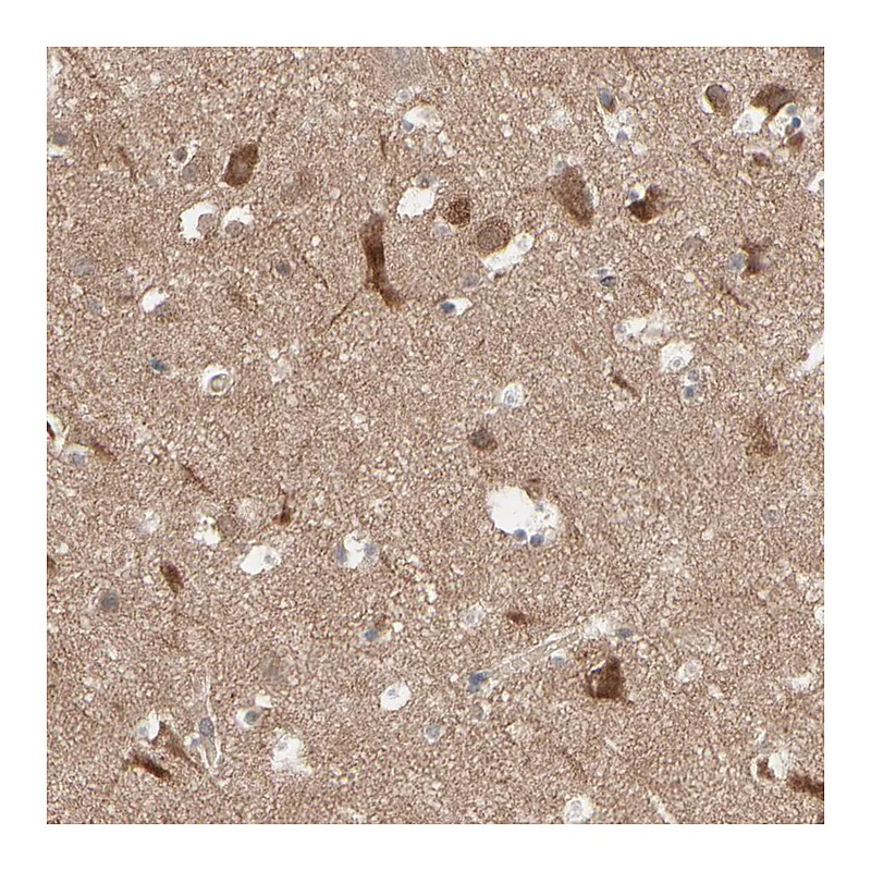Atlas Antibodies Anti-OPTN Antibody
