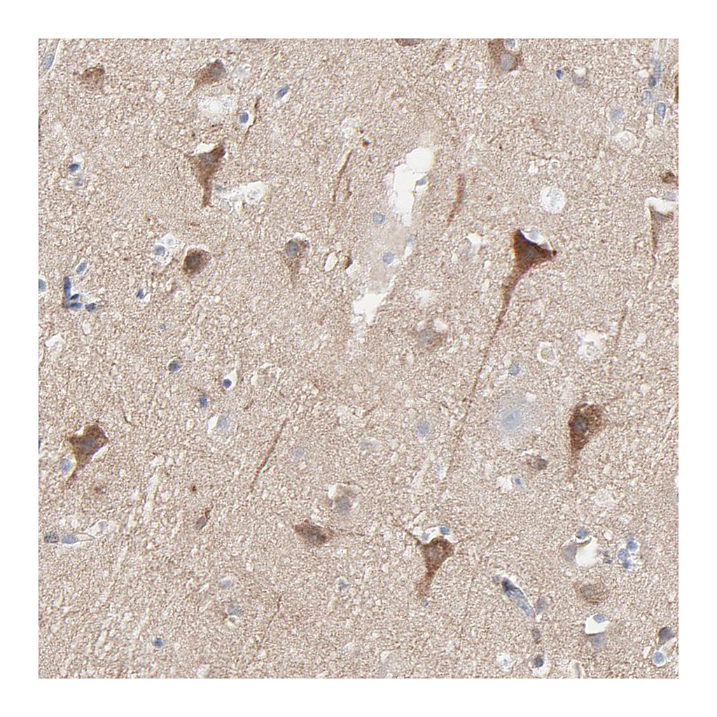 Atlas Antibodies Anti-OPTN Antibody