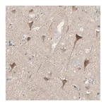 Atlas Antibodies Anti-OPTN Antibody