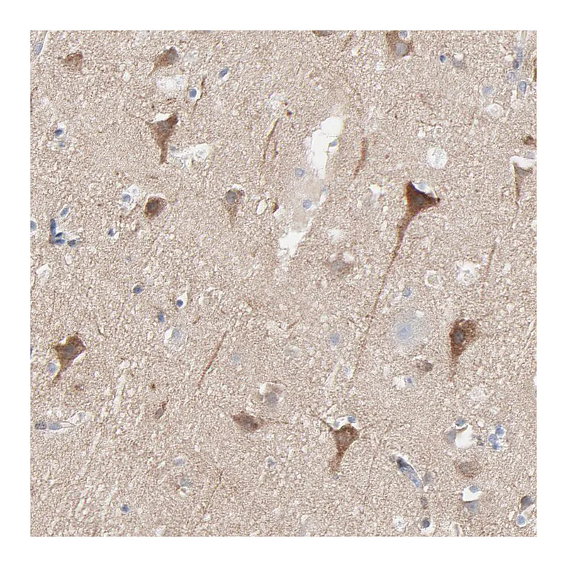 Atlas Antibodies Anti-OPTN Antibody