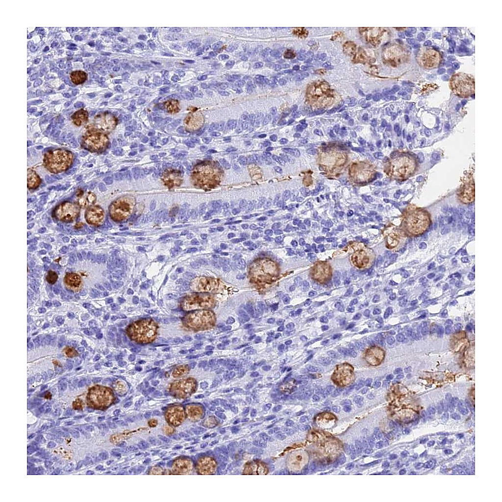 Atlas Antibodies Anti-OR10J3 Antibody