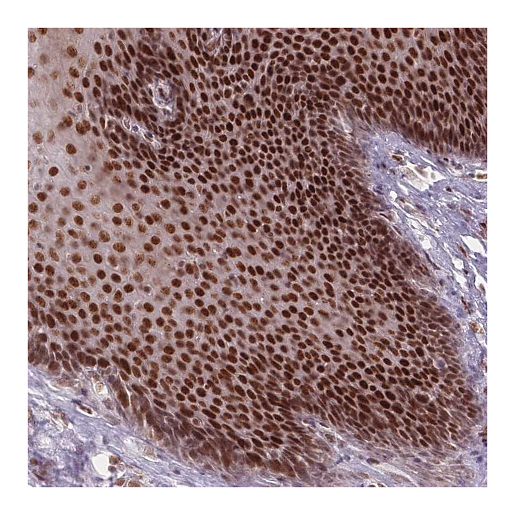 Atlas Antibodies Anti-OR10C1 Antibody